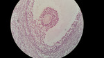 MISSING THUMBNAIL